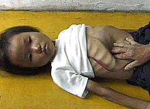 north-korean-famine-victim.gif